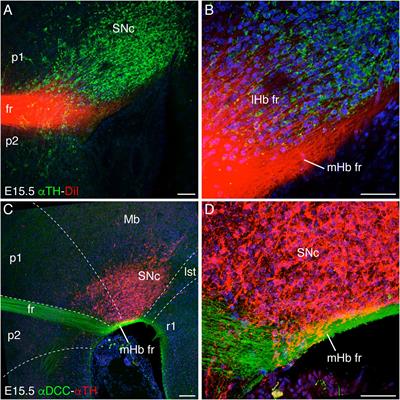 Netrin 1-Mediated Role of the Substantia Nigra Pars Compacta and Ventral Tegmental Area in the Guidance of the Medial Habenular Axons